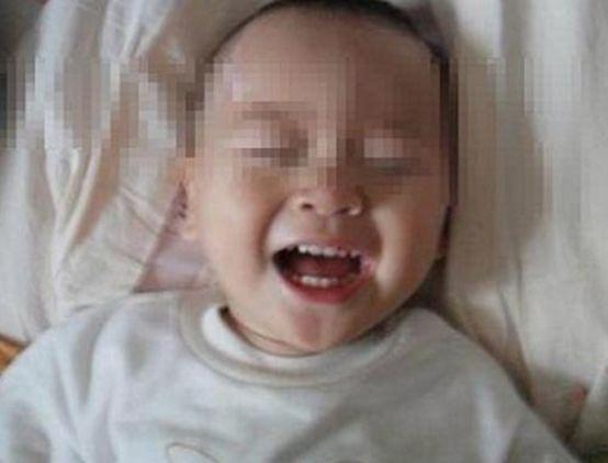 孩子不小心摔倒碰到后脑勺怎么办
