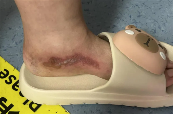 女子往鞋里倒敌敌畏