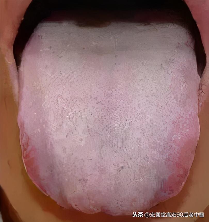 第1178页