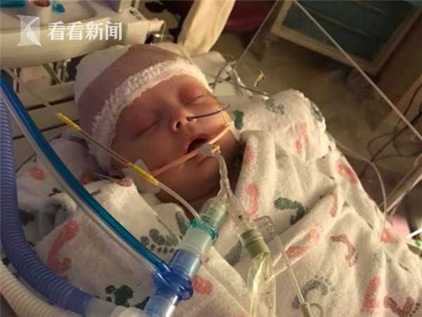 月嫂疏忽致29天婴儿重摔颅内出血