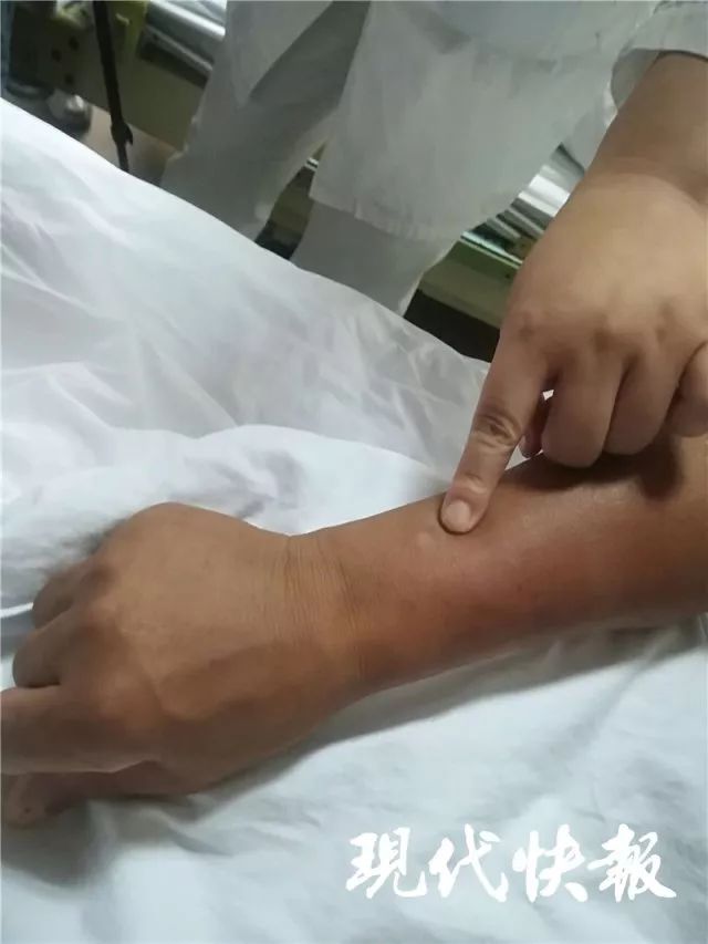 印度一医院2名新生儿被老鼠咬伤